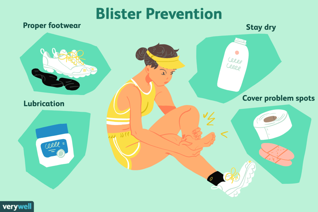 Tips for Preventing Blisters While Hiking