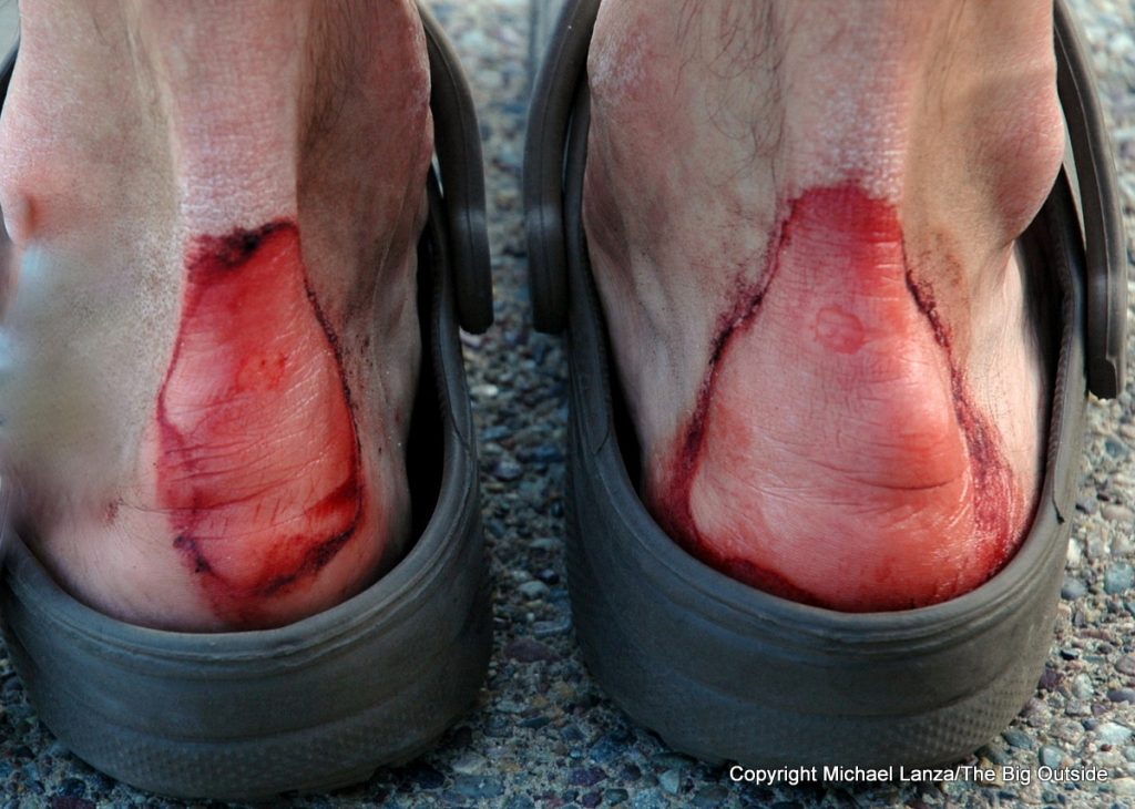 Tips for Preventing Blisters While Hiking