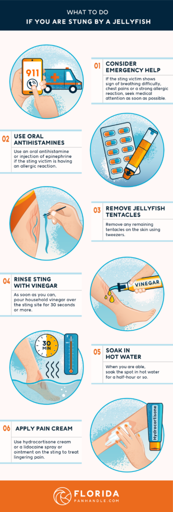 Effective Methods for Preventing and Treating Jellyfish Stings in Water Activities