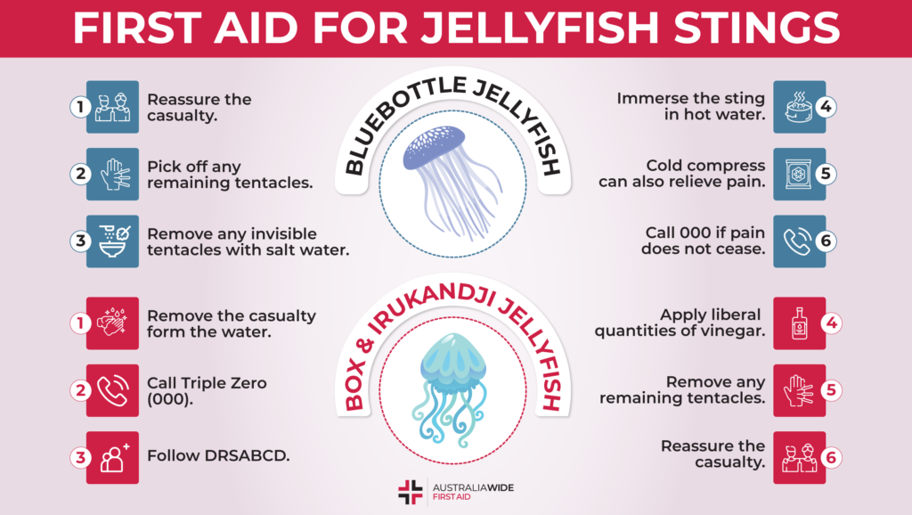 Effective Methods for Preventing and Treating Jellyfish Stings in Water Activities