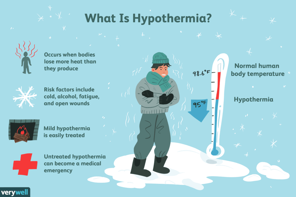 Essential Tips to Prevent and Treat Hypothermia in Cold-Water Sports